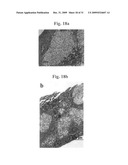 Therapeutic Transplantation Using Developing, Human or Porcine, Renal or Hepatic, Grafts diagram and image