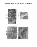 Therapeutic Transplantation Using Developing, Human or Porcine, Renal or Hepatic, Grafts diagram and image