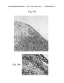 Therapeutic Transplantation Using Developing, Human or Porcine, Renal or Hepatic, Grafts diagram and image