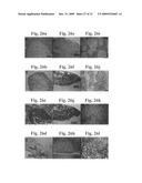 Therapeutic Transplantation Using Developing, Human or Porcine, Renal or Hepatic, Grafts diagram and image