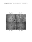 Therapeutic Transplantation Using Developing, Human or Porcine, Renal or Hepatic, Grafts diagram and image