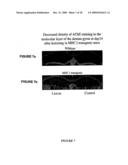 MODULATING NEURONAL OUTGROWTH VIA THE MAJOR HISTOCOMPATIBILITY COMPLEX CLASS I (MHC I) MOLECULE diagram and image