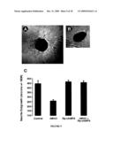 MODULATING NEURONAL OUTGROWTH VIA THE MAJOR HISTOCOMPATIBILITY COMPLEX CLASS I (MHC I) MOLECULE diagram and image