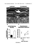 MODULATING NEURONAL OUTGROWTH VIA THE MAJOR HISTOCOMPATIBILITY COMPLEX CLASS I (MHC I) MOLECULE diagram and image