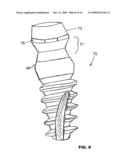 CONDENSING SKELETAL IMPLANT THAT FACILITATE INSERTIONS diagram and image