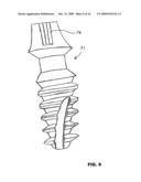 CONDENSING SKELETAL IMPLANT THAT FACILITATE INSERTIONS diagram and image