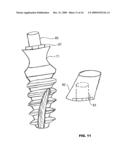 CONDENSING SKELETAL IMPLANT THAT FACILITATE INSERTIONS diagram and image