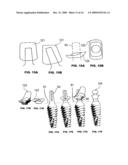 CONDENSING SKELETAL IMPLANT THAT FACILITATE INSERTIONS diagram and image