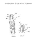 CONDENSING SKELETAL IMPLANT THAT FACILITATE INSERTIONS diagram and image