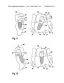 METHOD AND DEVICE FOR PRODUCING TOOTH PROSTHESIS PARTS diagram and image