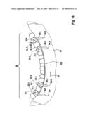 METHOD AND DEVICE FOR PRODUCING TOOTH PROSTHESIS PARTS diagram and image