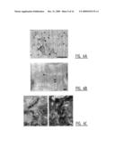 MEANS AND METHODS FOR DIAGNOSING AND/OR TREATING A SUBJECT AT RISK OF DEVELOPING HEART FAILURE diagram and image