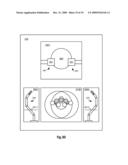 MEDICAL ROBOTIC SYSTEM PROVIDING AN AUXILARY VIEW INCLUDING RANGE OF MOTION LIMITATIONS FOR ARTICULATABLE INSTRUMENTS EXTENDING OUT OF A DISTAL END OF AN ENTRY GUIDE diagram and image