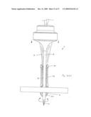 APPARATUS FOR INSERTING A SURGICAL DEVICE AT LEAST PARTIALLY THROUGH A WOUND OPENING diagram and image