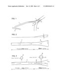 TUBULAR VASCULAR TRANSPLANT diagram and image