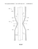 ACCESS CANNULA WITH HINGE RESTRICTOR diagram and image