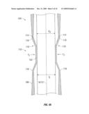 ACCESS CANNULA WITH HINGE RESTRICTOR diagram and image