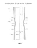 ACCESS CANNULA WITH HINGE RESTRICTOR diagram and image