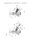 DRUG SOLUTION PREPARING KIT diagram and image