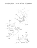 PATIENT INTERFACE SYSTEMS diagram and image