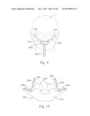 PATIENT INTERFACE SYSTEMS diagram and image