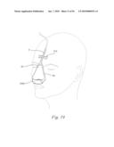 PATIENT INTERFACE SYSTEMS diagram and image