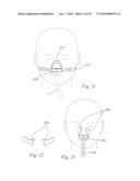 PATIENT INTERFACE SYSTEMS diagram and image