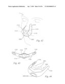 PATIENT INTERFACE SYSTEMS diagram and image