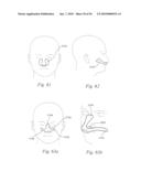 PATIENT INTERFACE SYSTEMS diagram and image