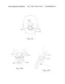 PATIENT INTERFACE SYSTEMS diagram and image