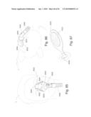 PATIENT INTERFACE SYSTEMS diagram and image