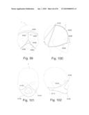 PATIENT INTERFACE SYSTEMS diagram and image