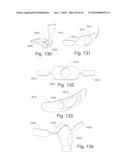 PATIENT INTERFACE SYSTEMS diagram and image