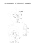 PATIENT INTERFACE SYSTEMS diagram and image