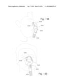 PATIENT INTERFACE SYSTEMS diagram and image