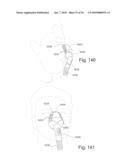 PATIENT INTERFACE SYSTEMS diagram and image