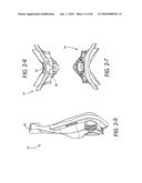 FOREHEAD SUPPORTS FOR FACIAL MASKS diagram and image