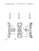 FOREHEAD SUPPORTS FOR FACIAL MASKS diagram and image