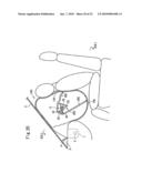 AIRBAG AND AIRBAG DEVICE diagram and image