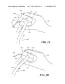 FOLDING CURRENT SENSOR diagram and image