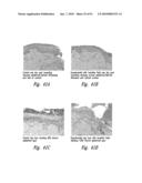 COMPOSITIONS AND METHODS FOR TREATING DIGESTIVE DISORDERS diagram and image