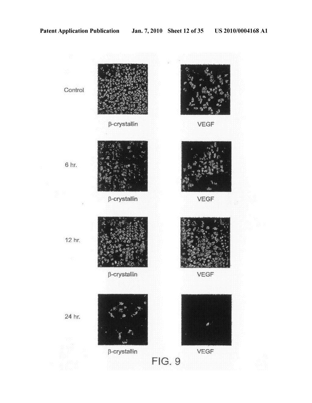 Use of Crystallin For The Modulation of Angiogenesis - diagram, schematic, and image 13