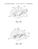 SYSTEMS AND METHODS FOR VARYING ELECTROMAGNETIC AND ADJUNCTIVE NEURAL THERAPIES diagram and image