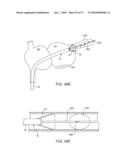 TISSUE VISUALIZATION AND MANIPULATION SYSTEMS diagram and image