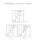 ABNORMALITY FINDING IN PROJECTION IMAGES diagram and image