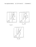 ABNORMALITY FINDING IN PROJECTION IMAGES diagram and image