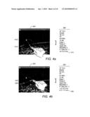 USER INTERFACE FOR ULTRASOUND MAMMOGRAPHIC IMAGING diagram and image