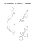 METHODS AND DEVICES FOR MINIMALLY-INVASIVE EXTRAOCULAR DELIVERY OF RADIATION TO THE POSTERIOR PORTION OF THE EYE diagram and image