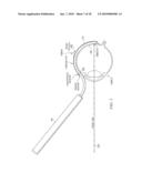 METHODS AND DEVICES FOR MINIMALLY-INVASIVE EXTRAOCULAR DELIVERY OF RADIATION TO THE POSTERIOR PORTION OF THE EYE diagram and image