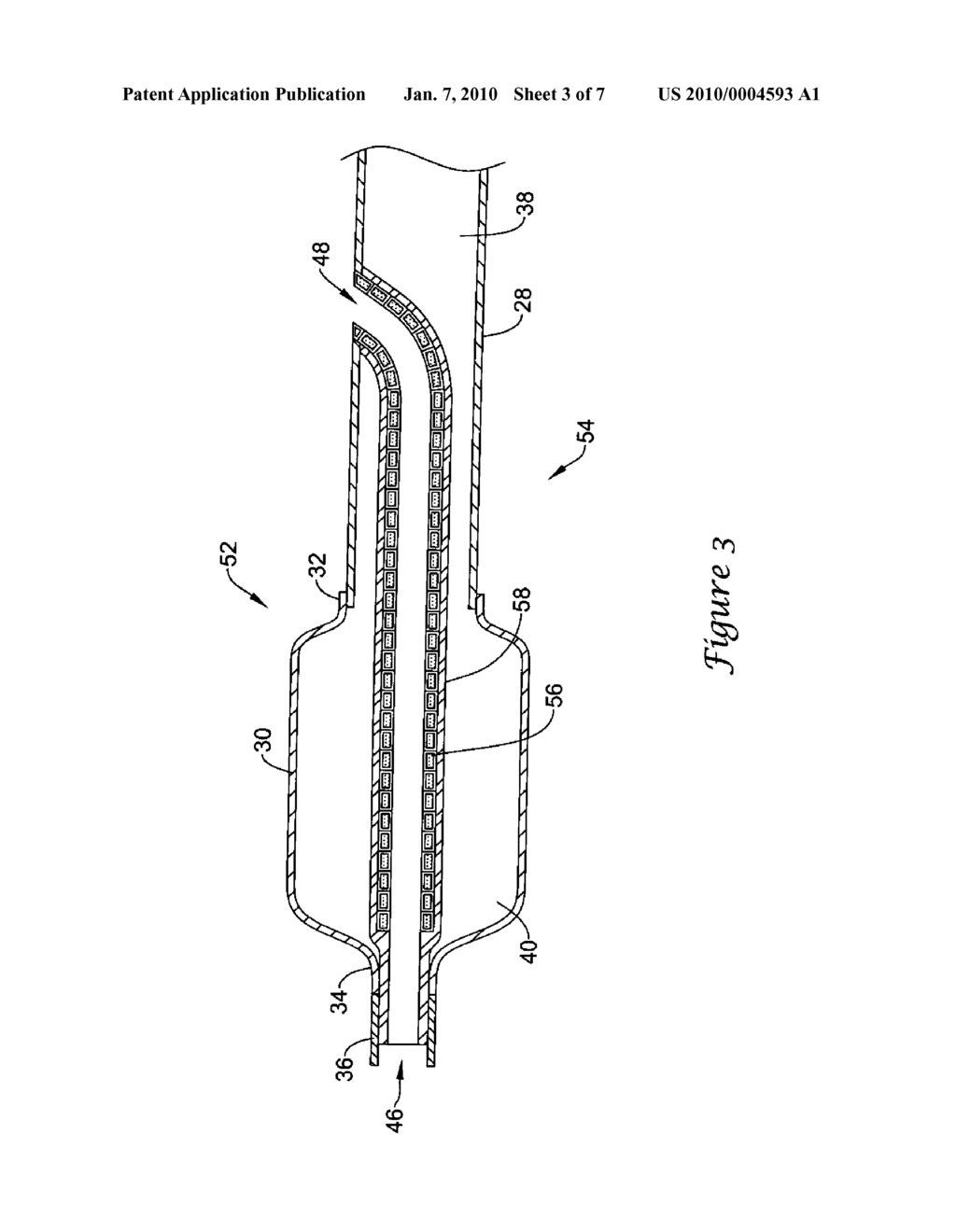 BALLOON CATHETER - diagram, schematic, and image 04